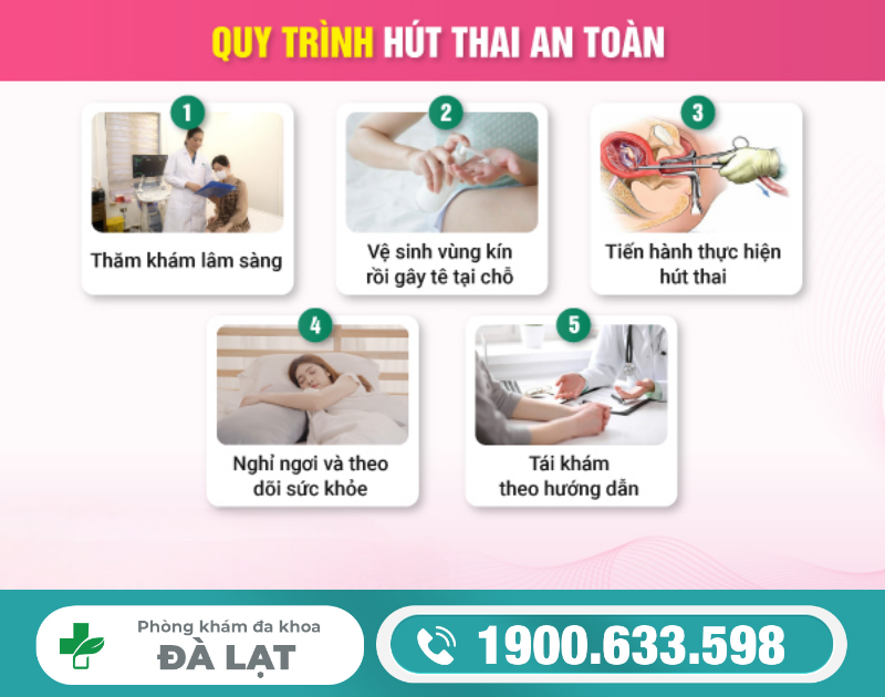 Hình ảnh minh họa
